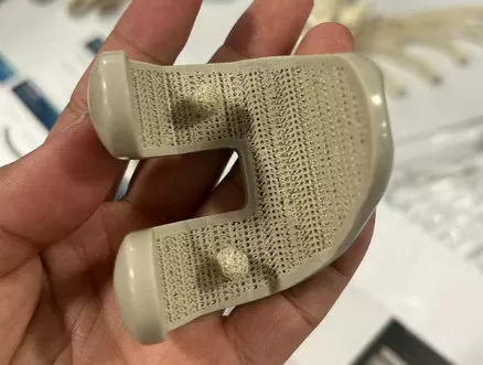 Medical-Grade 3D Printed PEEK Implants