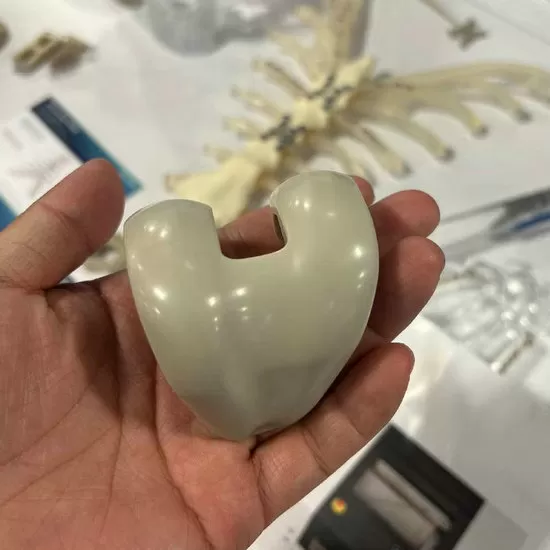 Medical-Grade 3D Printed PEEK Implants