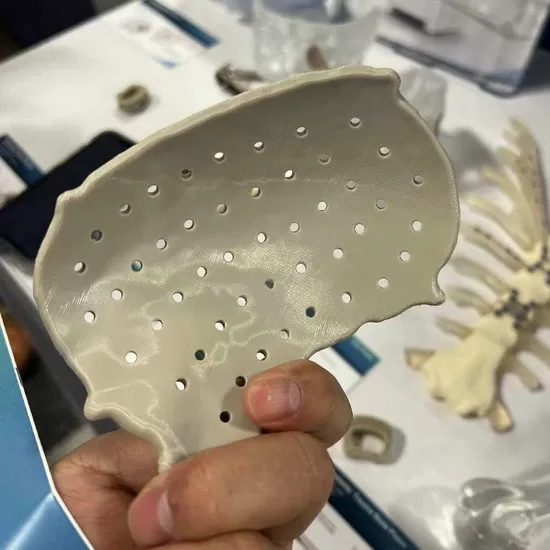Medical-Grade 3D Printed PEEK Implants