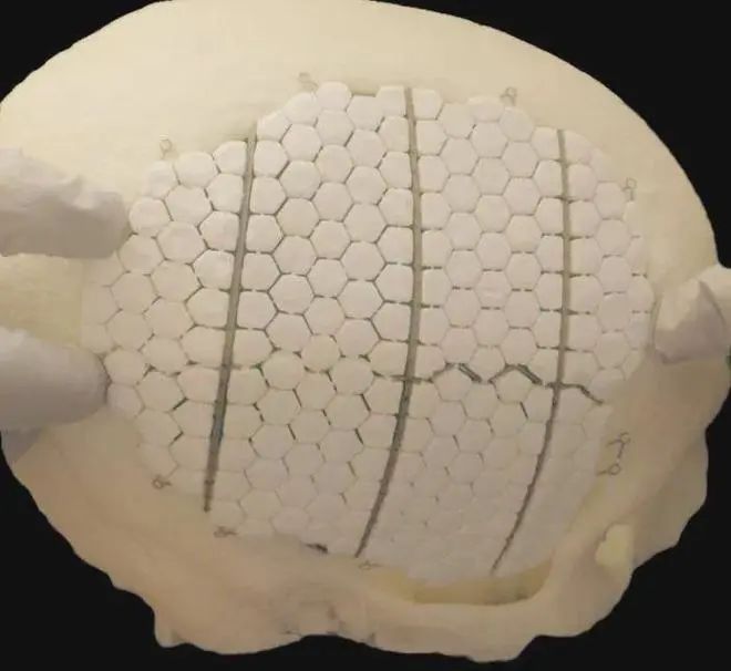 PEEK - Advanced material for cranioplasty