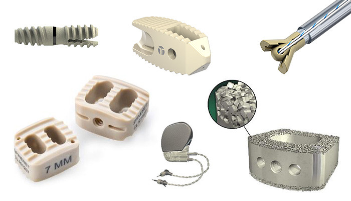 Top 8 Benefits of PEEK in Medical Applications Top 8 Benefits of PEEK in Medical Applications