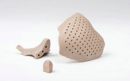 Basel Hospital 3D Prints First On-Site PEEK Maxillofacial Implant